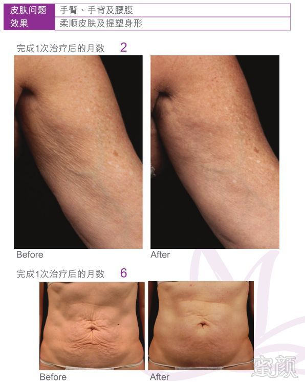 https://img.miyanlife.com/mnt/timg/180910/12150A353-15.jpg