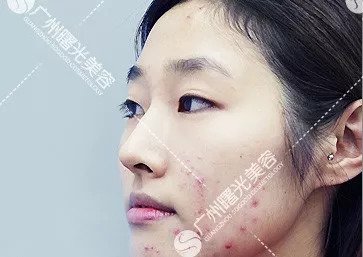 https://img.miyanlife.com/mnt/timg/180910/12192122F-3.jpg