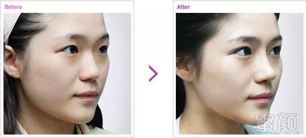 https://img.miyanlife.com/mnt/timg/180910/121P62449-3.jpg