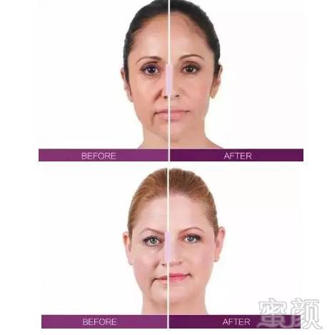 https://img.miyanlife.com/mnt/timg/180910/12240V150-7.jpg