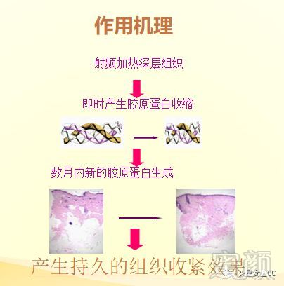 https://img.miyanlife.com/mnt/timg/180910/12295R158-6.jpg