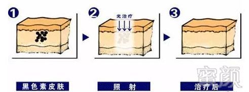 https://img.miyanlife.com/mnt/timg/180910/122Q63U3-8.jpg