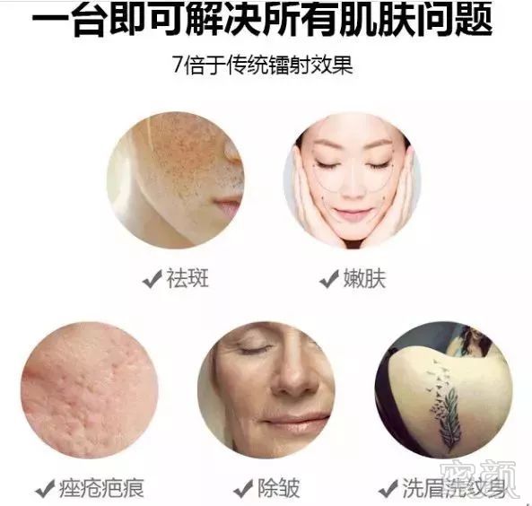 https://img.miyanlife.com/mnt/timg/180910/122QC201-10.jpg