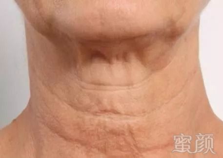 https://img.miyanlife.com/mnt/timg/180910/124U4N92-5.jpg