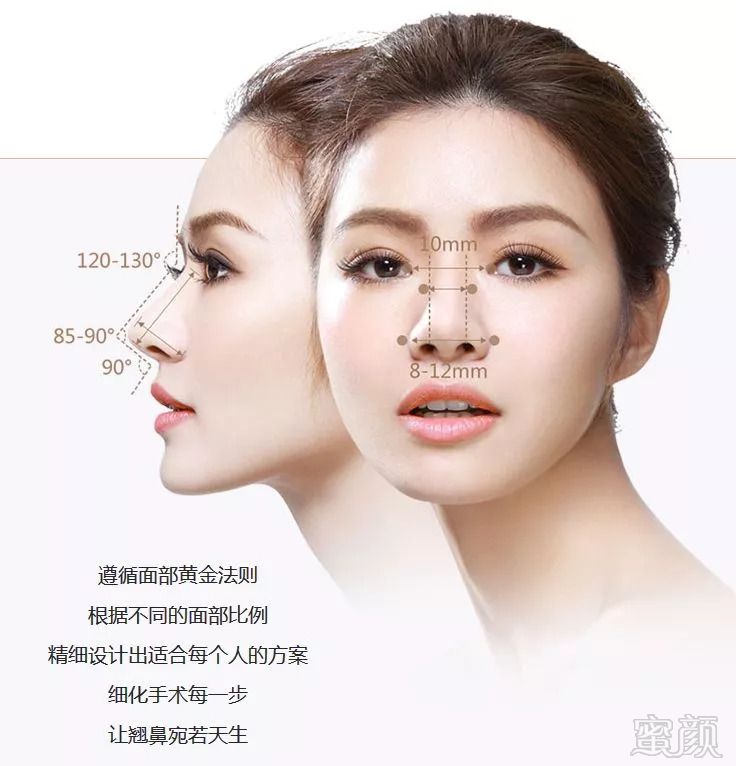 https://img.miyanlife.com/mnt/timg/180910/1251303020-1.jpg