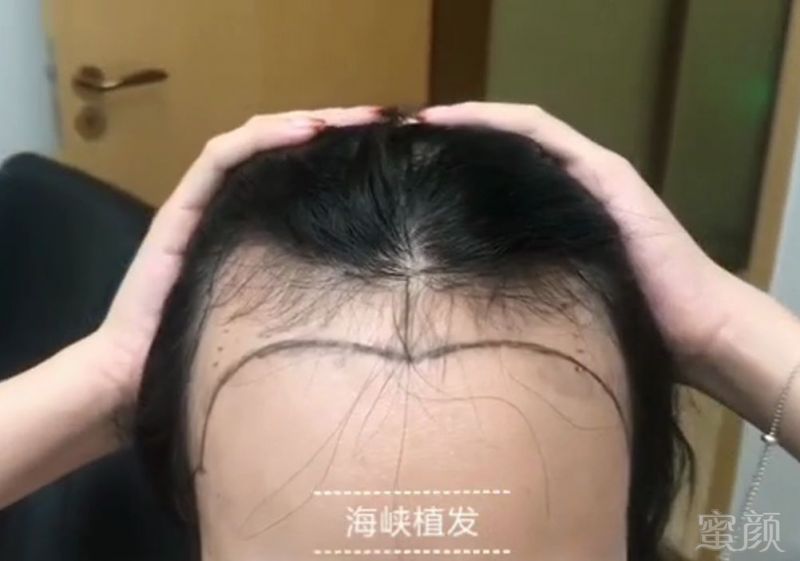 https://img.miyanlife.com/mnt/timg/180910/130K354U-3.jpg