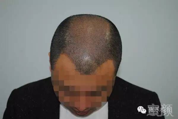 https://img.miyanlife.com/mnt/timg/180910/13202R016-9.jpg