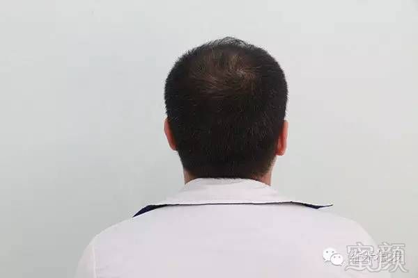 https://img.miyanlife.com/mnt/timg/180910/13202U262-3.jpg