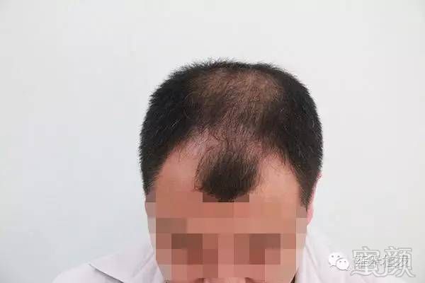 https://img.miyanlife.com/mnt/timg/180910/13202U340-0.jpg