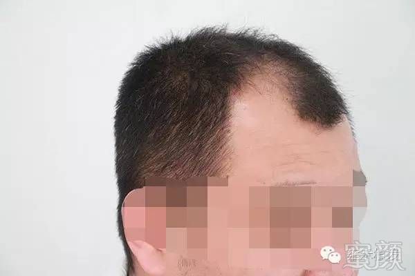 https://img.miyanlife.com/mnt/timg/180910/13202VH8-1.jpg