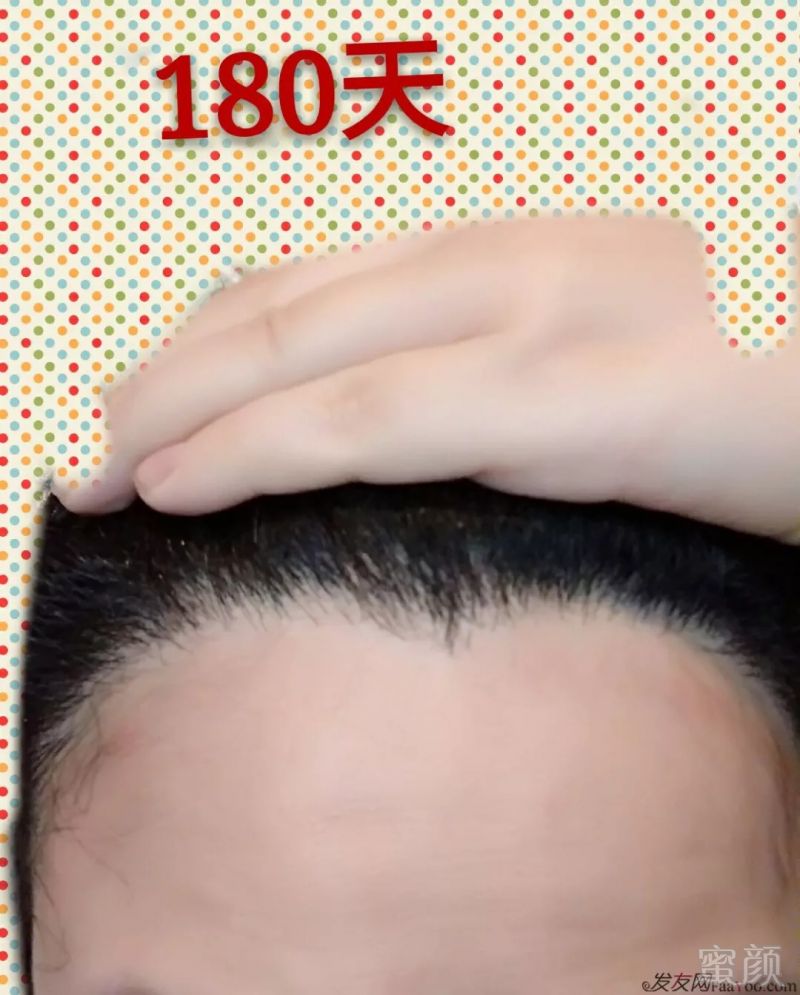 https://img.miyanlife.com/mnt/timg/180911/11043530J-13.jpg