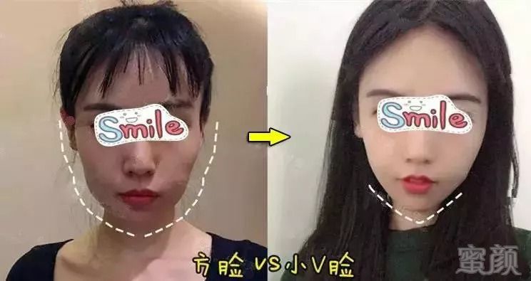 https://img.miyanlife.com/mnt/timg/180911/11050I227-4.jpg