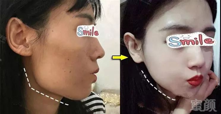 https://img.miyanlife.com/mnt/timg/180911/11050J203-5.jpg