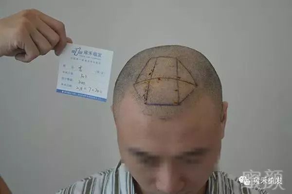https://img.miyanlife.com/mnt/timg/180911/110912KZ-3.jpg