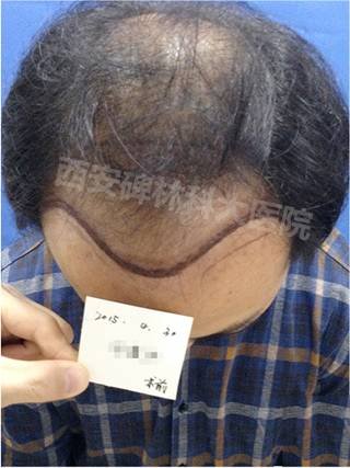 https://img.miyanlife.com/mnt/timg/180911/110S92028-1.jpg