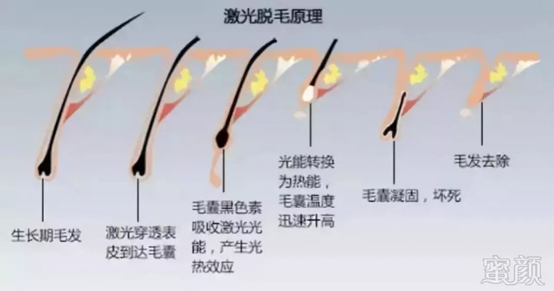 https://img.miyanlife.com/mnt/timg/180911/11202JS6-2.jpg