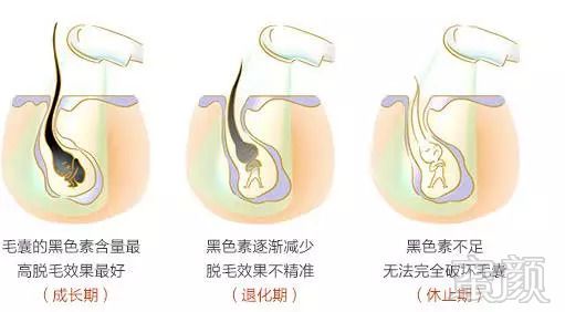 https://img.miyanlife.com/mnt/timg/180911/11202Jb3-3.jpg