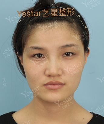 https://img.miyanlife.com/mnt/timg/180911/113015H54-4.jpg