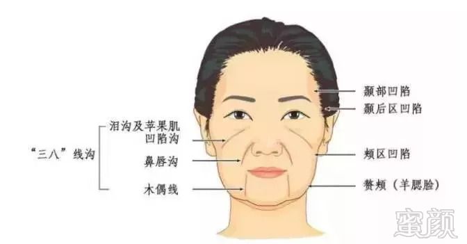 https://img.miyanlife.com/mnt/timg/180911/1131421959-1.jpg