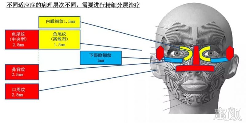 https://img.miyanlife.com/mnt/timg/180911/11314433M-11.jpg
