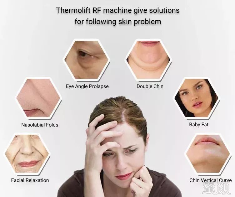 https://img.miyanlife.com/mnt/timg/180911/113144K16-12.jpg