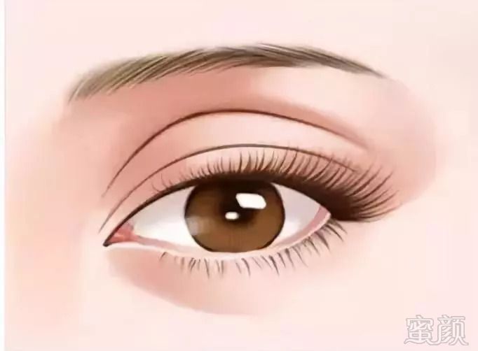 https://img.miyanlife.com/mnt/timg/180911/113K31E5-2.jpg