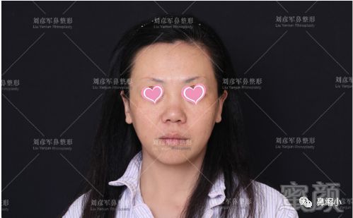 https://img.miyanlife.com/mnt/timg/180911/1156101052-0.jpg