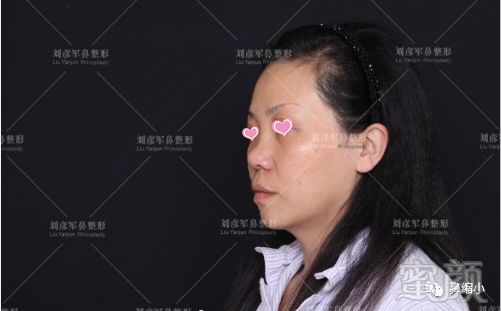 https://img.miyanlife.com/mnt/timg/180911/11561130F-1.jpg
