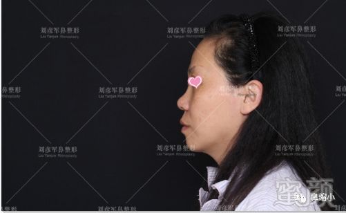 https://img.miyanlife.com/mnt/timg/180911/1156113617-2.jpg