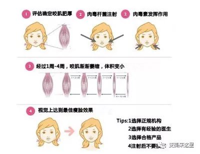 https://img.miyanlife.com/mnt/timg/180911/115FA124-1.jpg