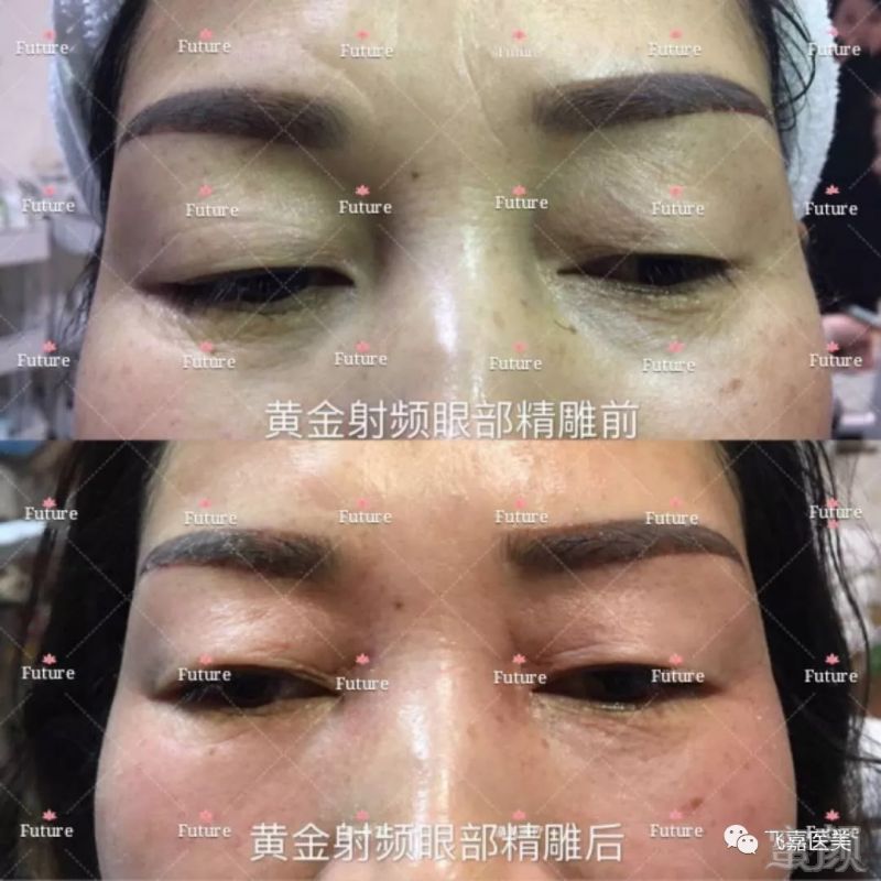 https://img.miyanlife.com/mnt/timg/180911/1201023457-9.jpg