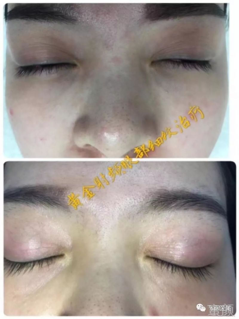 https://img.miyanlife.com/mnt/timg/180911/120102C54-10.jpg