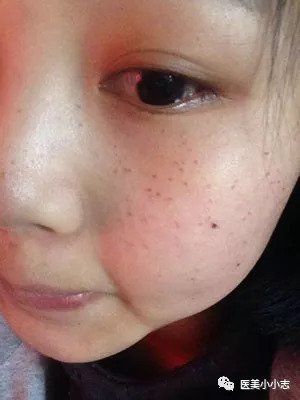 https://img.miyanlife.com/mnt/timg/180911/120S24O2-3.jpg