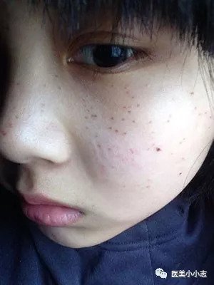 https://img.miyanlife.com/mnt/timg/180911/120S2EJ-2.jpg