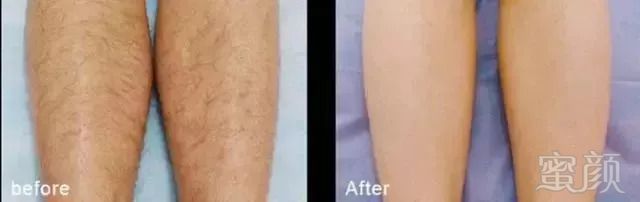 https://img.miyanlife.com/mnt/timg/180911/12155Q507-11.jpg