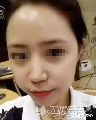 https://img.miyanlife.com/mnt/timg/180911/121P14315-3.jpg