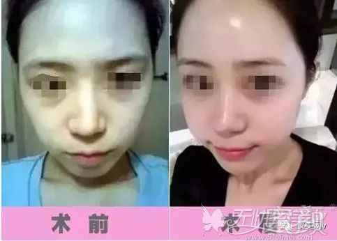 https://img.miyanlife.com/mnt/timg/180911/121P15042-4.jpg