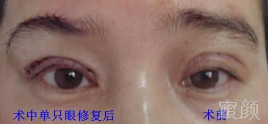https://img.miyanlife.com/mnt/timg/180911/122341GP-2.jpg