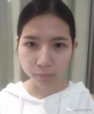 https://img.miyanlife.com/mnt/timg/180911/12492555M-0.jpg