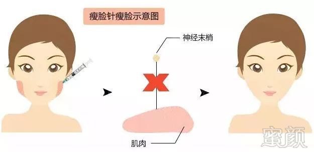 https://img.miyanlife.com/mnt/timg/180911/130029AT-3.jpg