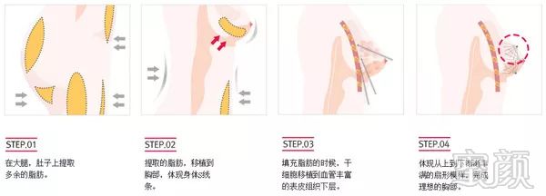 https://img.miyanlife.com/mnt/timg/180911/13032aQ7-5.jpg