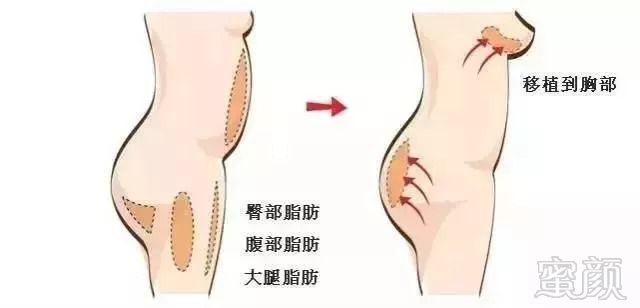 https://img.miyanlife.com/mnt/timg/180911/130330C03-8.jpg