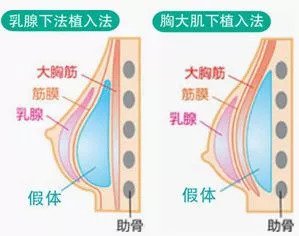 https://img.miyanlife.com/mnt/timg/180911/130330HK-7.jpg