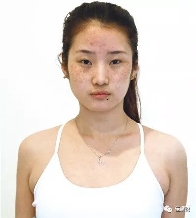 https://img.miyanlife.com/mnt/timg/180911/1314515T9-0.jpg