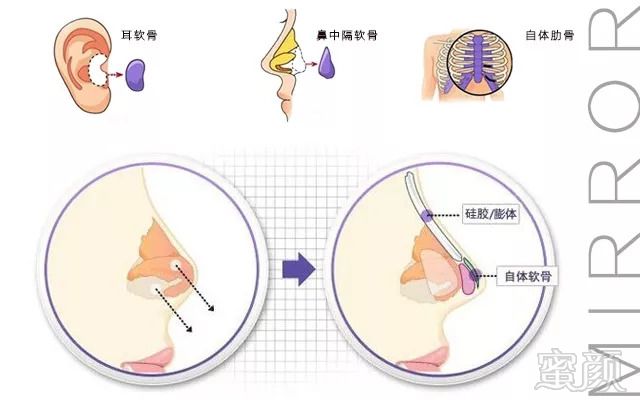 案例图片