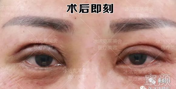 https://img.miyanlife.com/mnt/timg/180911/1325162213-1.jpg