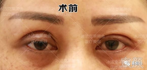 https://img.miyanlife.com/mnt/timg/180911/13251A033-0.jpg