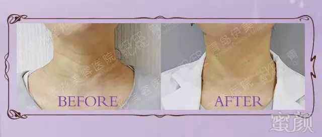 https://img.miyanlife.com/mnt/timg/180911/133643H22-10.jpg