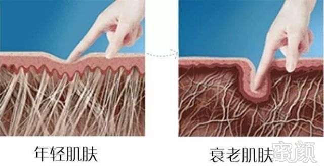 https://img.miyanlife.com/mnt/timg/180912/104621OI-1.jpg