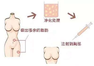 https://img.miyanlife.com/mnt/timg/180912/110P46045-0.jpg